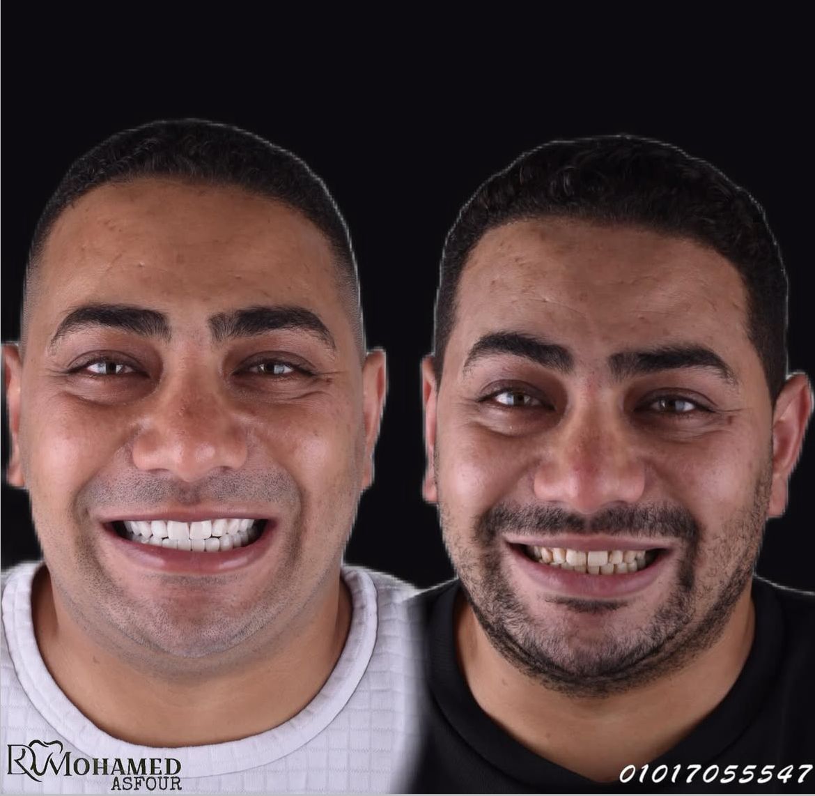 التجميل
